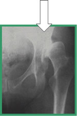 LOR asymmetrische cup