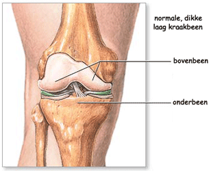normale, dikke laag kraakbeen