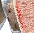 microfracturen worden gecreëerd om fibro cartilago te vormen