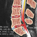 NMR MRI