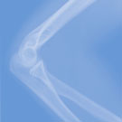 Dr. Mortelé, orthopedie