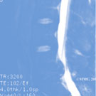 Dr. Mortelé, orthopedie