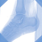 Dr. Mortelé, orthopedie
